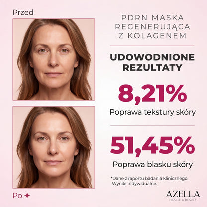 Lumella — 4 Maseczki